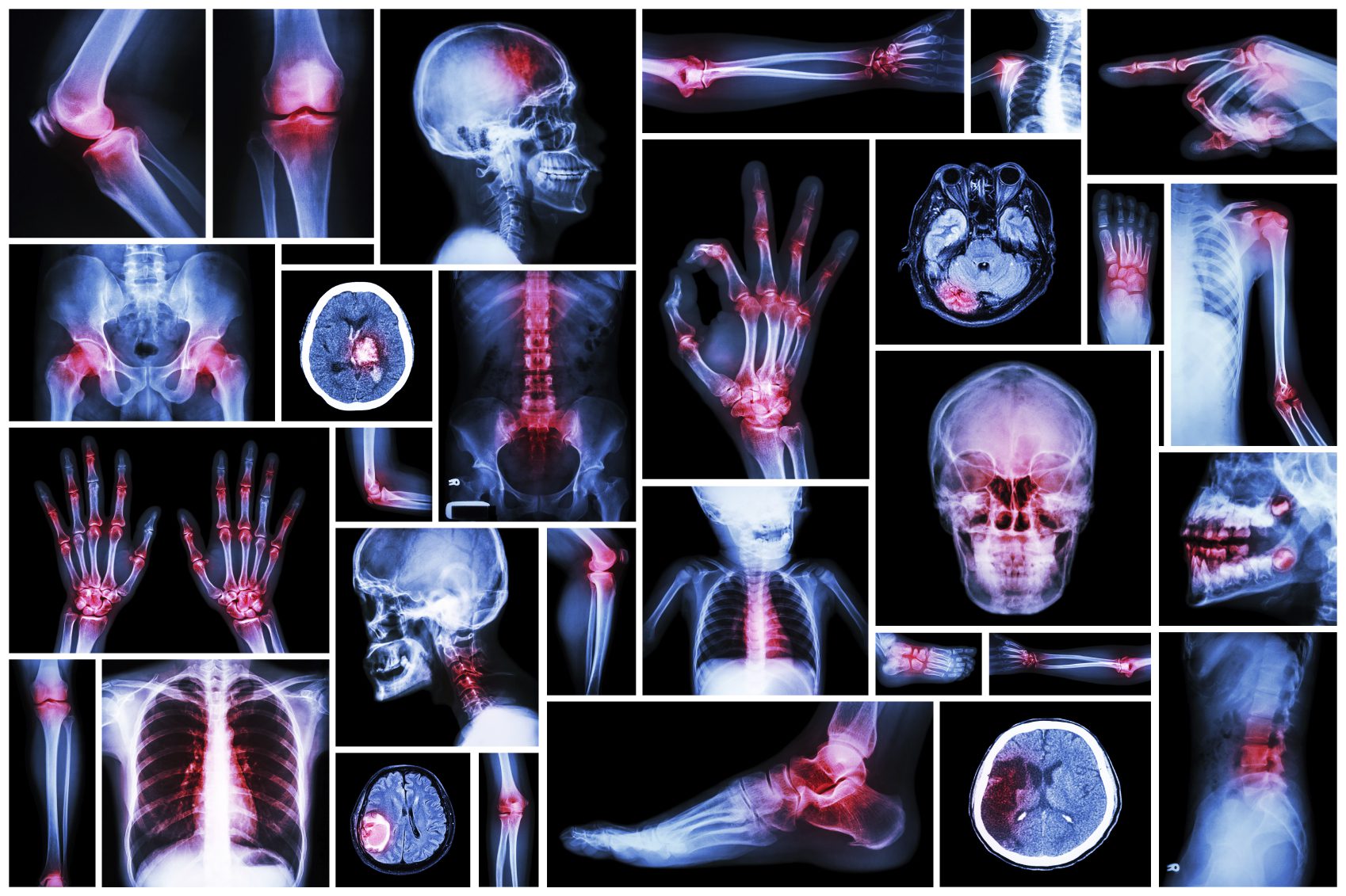 Reduce your arthritis pain naturally!